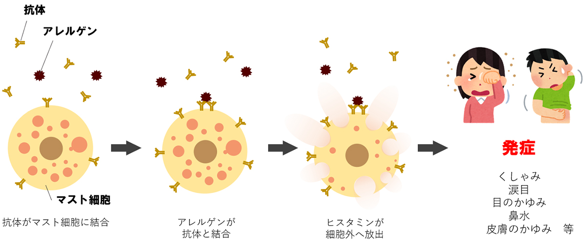 アレルギーが起きる仕組み イラスト